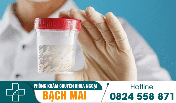 Một số bệnh tinh dịch thường gặp và cách điều trị hiệu quả 4