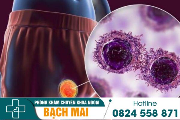 Đau tinh hoàn phải: Nguyên nhân và phương pháp điều trị hiệu quả 2