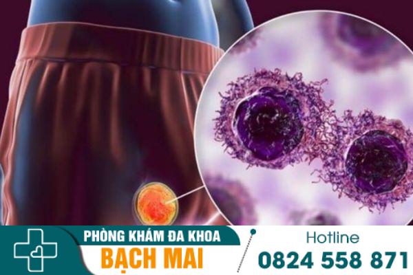 Đau nhức tinh hoàn là hiện tượng xảy ra khá phổ biến ở nam giới
