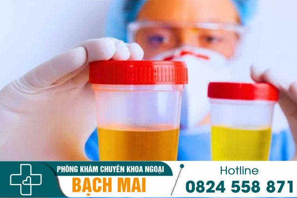 Nước tiểu màu vàng là dấu hiệu cảnh báo bệnh gì? 2