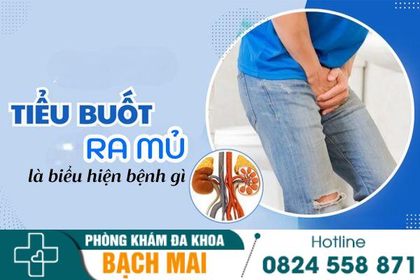 Nam giới bị đi tiểu buốt ra mủ là bệnh gì?