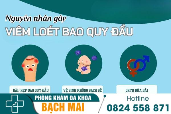 Nguyên nhân viêm loét bao quy đầu và phương pháp chữa trị hiệu quả 24 Nguyên nhân gây viêm loét bao quy đầu là gì?