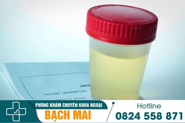 Nước tiểu đục ở nam giới là do những nguyên nhân nào? 2