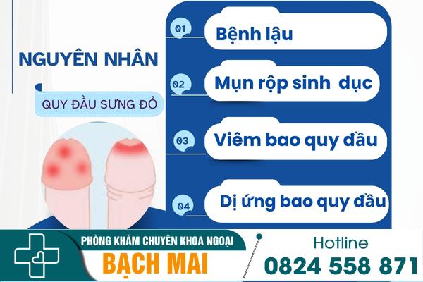 Hiện tượng quy đầu sưng đỏ là dấu hiệu của bệnh gì? 4
