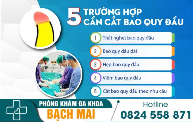Cắt bao quy đầu – Những thông tin quan trọng 6