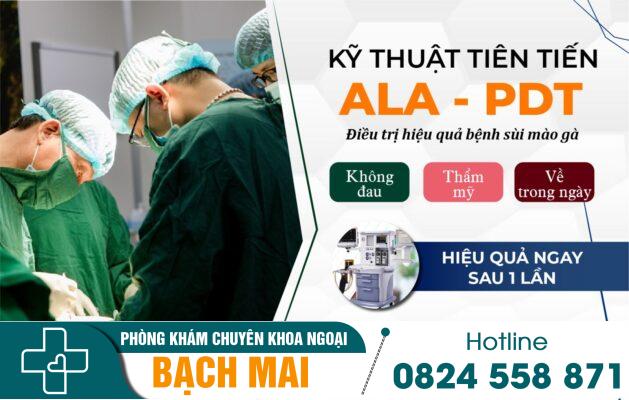 Sùi mào gà dương vật: Nguyên nhân và phương pháp điều trị 28 Hỗ trợ điều trị sùi mào gà dương vật bằng phương pháp ALA - PDT