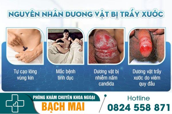 Nguyên nhân gây trầy xước dương vật