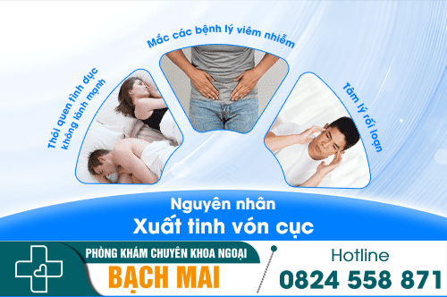 Nguyên nhân xuất tinh vón cục ở nam giới