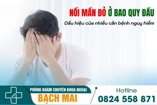 Địa chỉ chữa nổi mẩn đỏ ở bao quy đầu uy tín tại Thái Nguyên 6