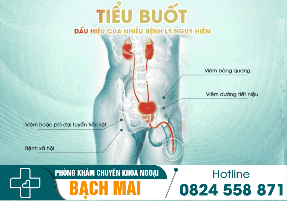 Tiểu buốt - Dấu hiệu cảnh báo bệnh lý nguy hiểm chớ xem thường