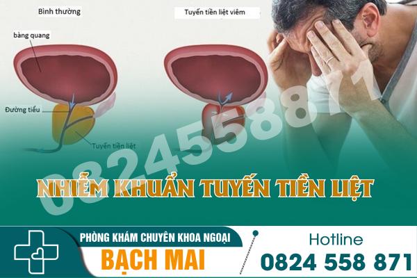 Những triệu chứng điển hình của nhiễm khuẩn tuyến tiền liệt 8