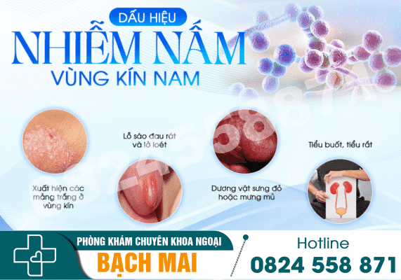 Dấu hiệu nhận biết bị nấm bộ phận sinh dục nam