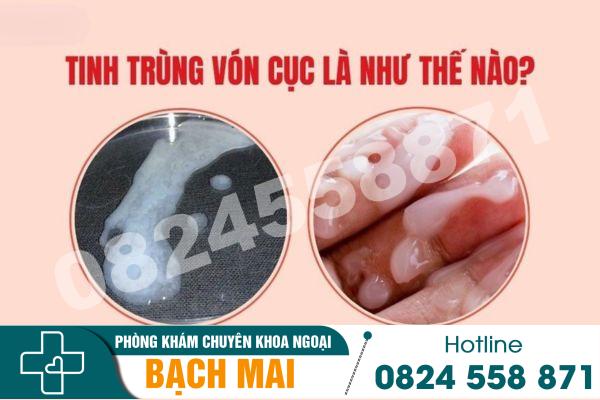 Tìm hiểu hiện tượng xuất tinh vón cục ở nam giới