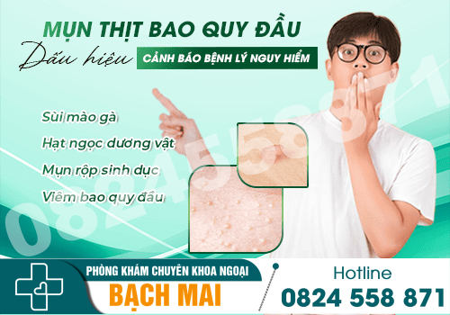 Mụn thịt bao quy đầu là dấu hiệu bệnh gì? Cách điều trị hiệu quả 10 Mụn thịt bao quy đầu - Dấu hiệu cảnh báo nhiều bệnh lý nguy hiểm