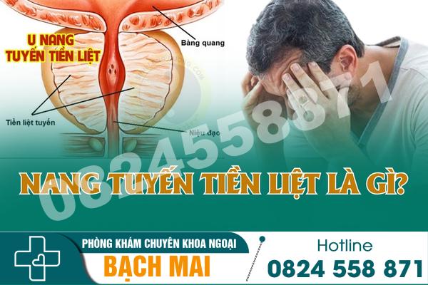Nang tuyến tiền liệt là gì? Có nên điều trị bằng thuốc? 2