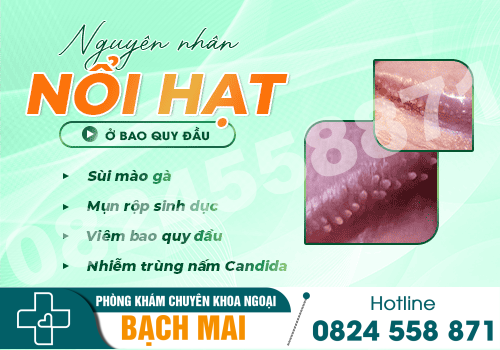 Nổi hạt ở bao quy đầu – Nguyên nhân do đâu?