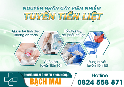 Những thông tin tổng quan viêm tuyến tiền liệt và địa chỉ hỗ trợ điều trị 2