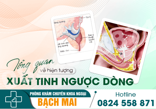 Tổng quan về hiện tượng xuất tinh ngược dòng