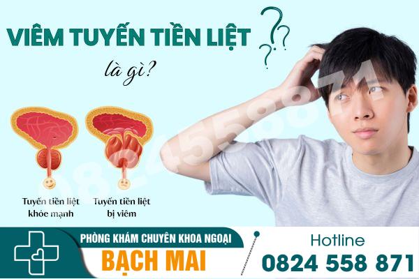 Viêm tuyến tiền liệt là gì?